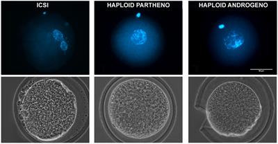 Dysregulated Gene Expression of Imprinted and X-Linked Genes: A Link to Poor Development of Bovine Haploid Androgenetic Embryos